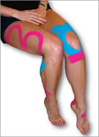 Kinesio Tape on legs